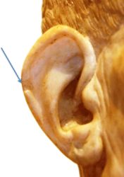 Ear Auricle
