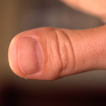 Previous thumb